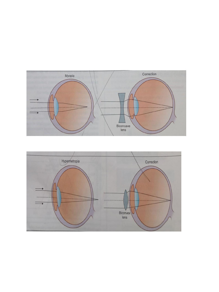 Errors of Refraction and Anatomy Overview | PDF | Vertebral Column ...