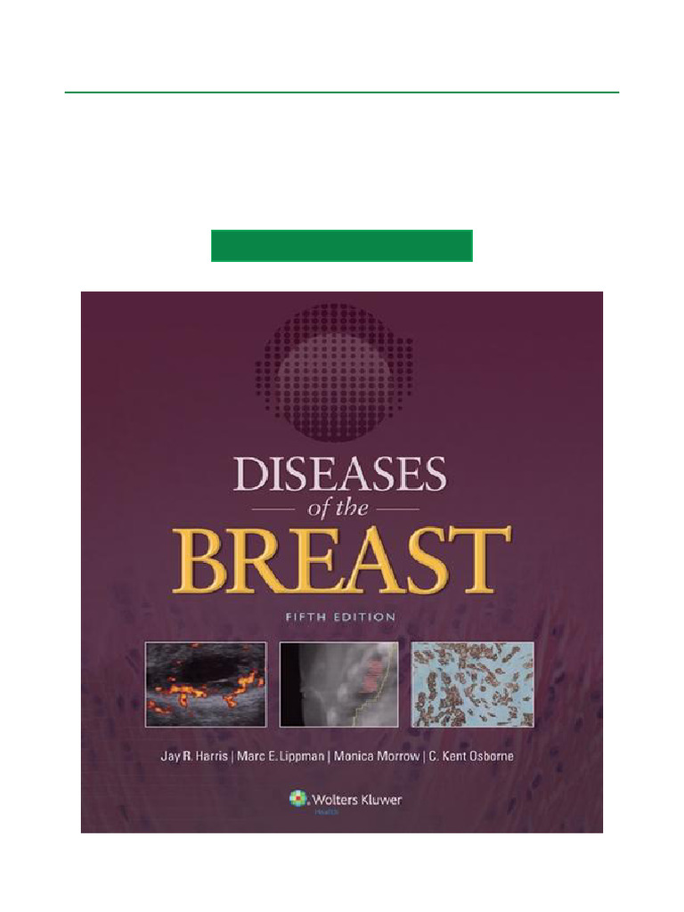 【裁断済】Breast Tumours 5th Edition Breast Tumours: WHO Classification of Tumours (Medicine
