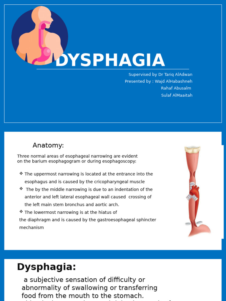 Cricopharyngeal Narrowing in Dysphagia | PDF | Esophagus | Medical ...