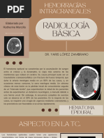 Tipos de Hematomas Cerebrales | PDF | Sistema nervioso | Especialidades ...