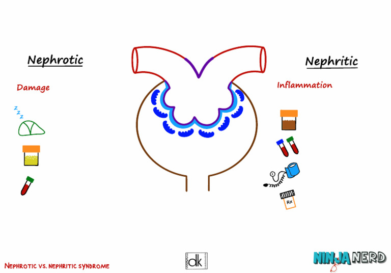 Nephrotic Vs Nephritic Atf | PDF