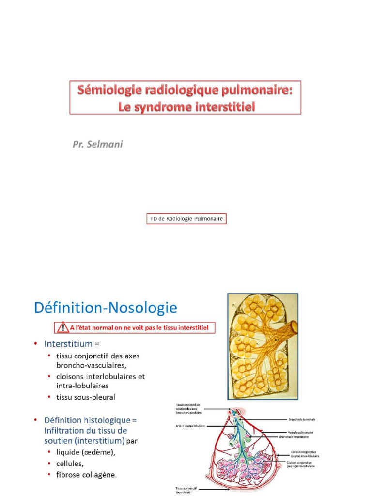 SD Interstitiel 01 | PDF