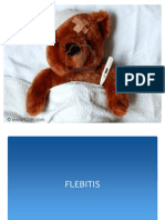 Flebitis