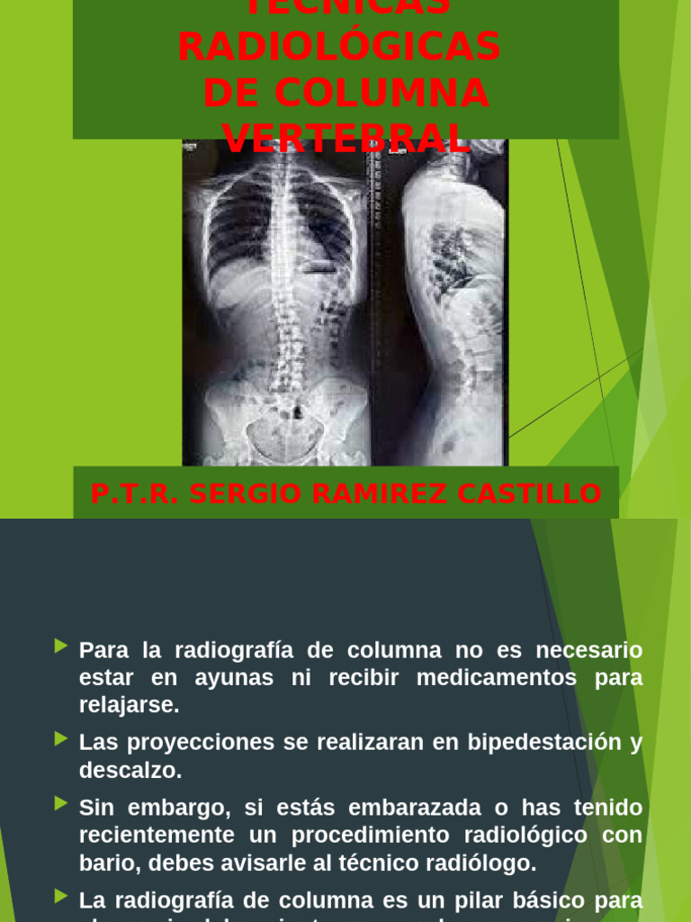 Técnicas Radiológicas de Columna Vertebral | PDF | La columna vertebral ...