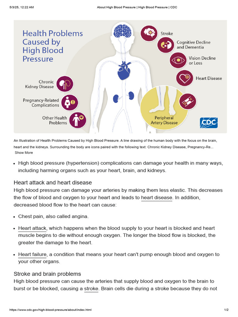 About High Blood Pressure - High Blood Pressure - CDC3 | PDF ...