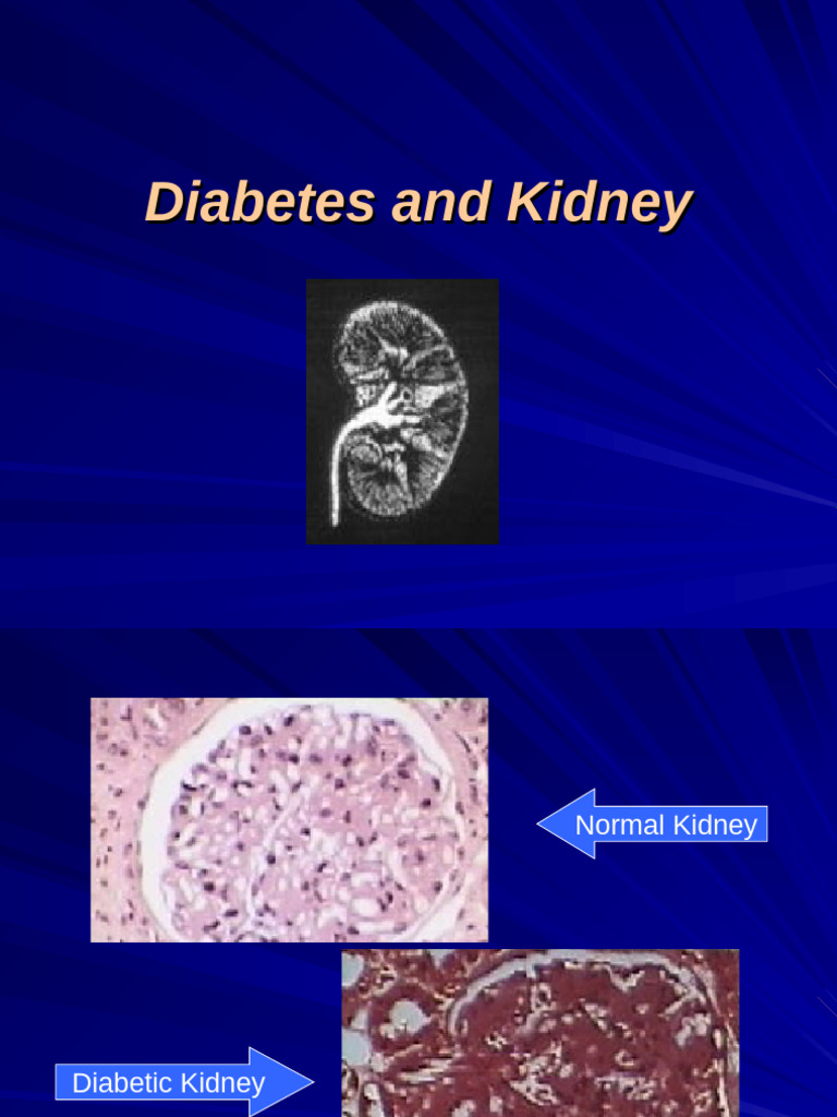 Diabetes and Kidney Health Management | PDF | Kidney Disease | Diabetes