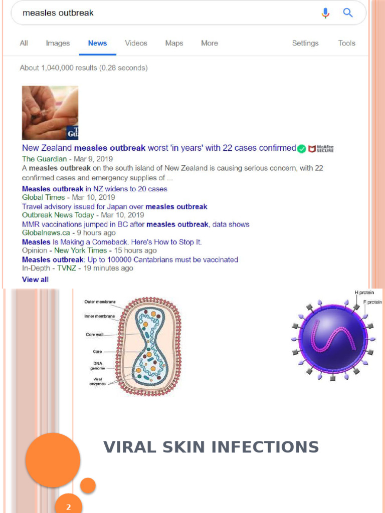Viral Skin Infections | PDF | Virus | Measles