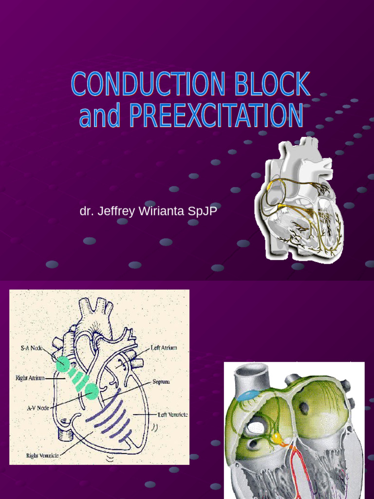 Conduction Block, Preexcitation | PDF