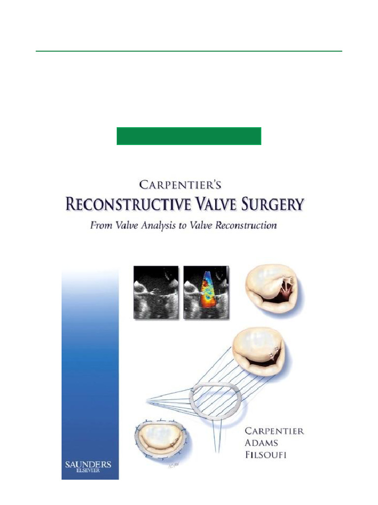 Carpentier's Reconstructive Valve Surgery， 1e Carpentier's