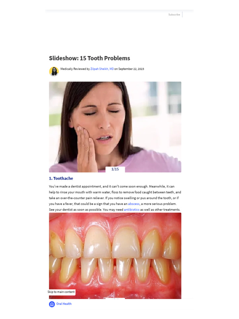Common Dental Problems Explained | PDF | Human Tooth | Dentistry