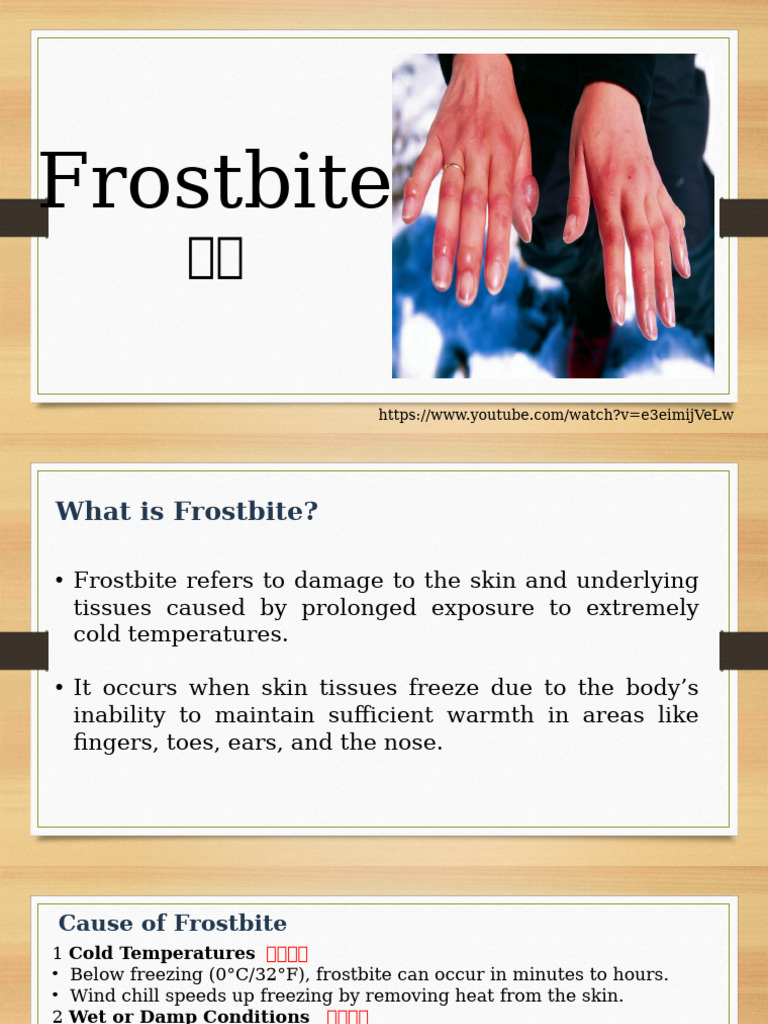 Understanding Frostbite Symptoms and Treatment | PDF | Medical ...