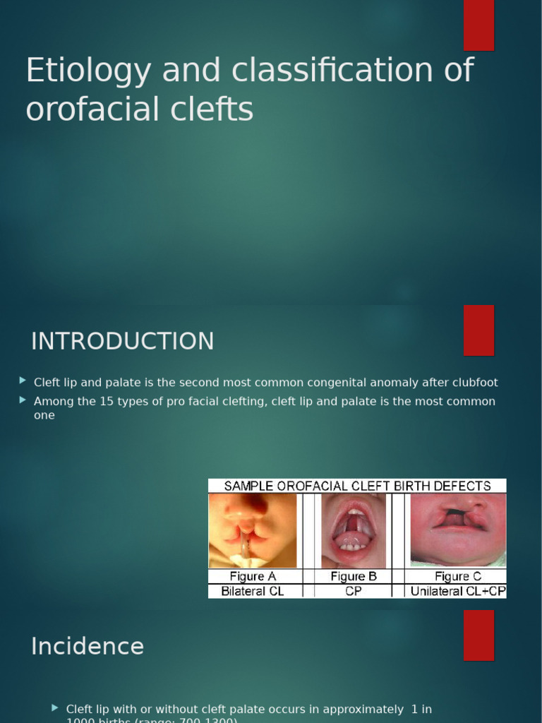 Orofacial Clefts: Etiology & Classification | PDF | Congenital Disorder ...