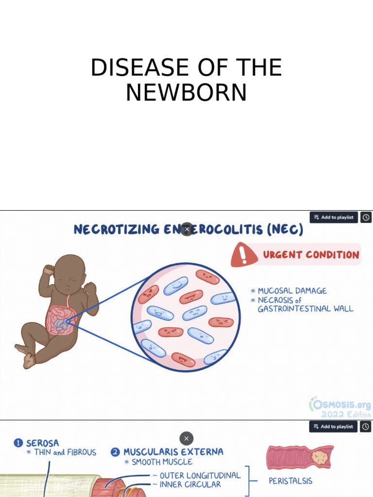 Disease of The Newborn | PDF