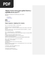 Download Alguna Receta Casera Para Quitar Barros y Espinillas de La Cara by ger457 SN85770753 doc pdf