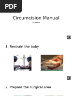 Dorsal Slit Circumcision Procedure Guide | PDF | Surgical Suture | Surgery