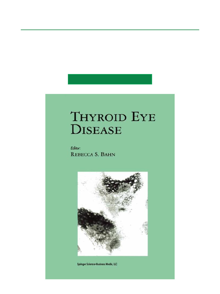 Thyroid Eye Disease Overview and Treatment | PDF | Western Blot | Antibody