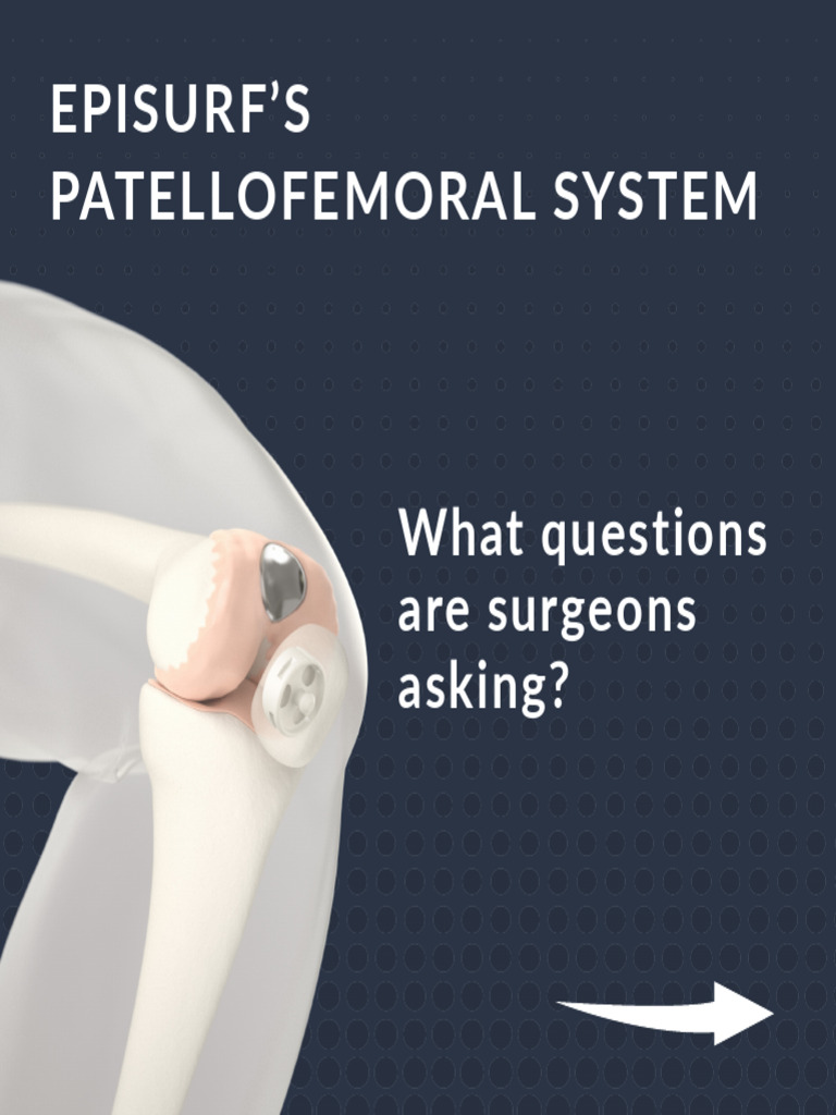 Episurf's PFJ - What Are Surgeons Asking About | PDF | Medicine ...