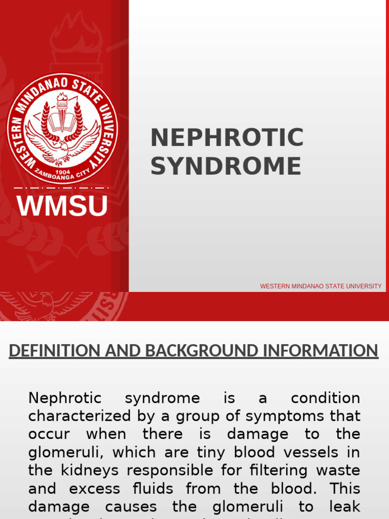 Nephrotic Syndrome Maldisa | PDF | Edema | Medicine