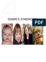 Down's Syndrome2