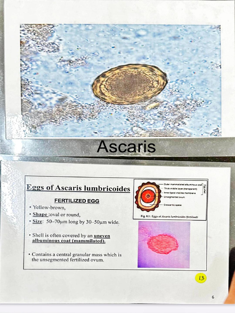 Eggs and Cysts in Stool Examination | PDF