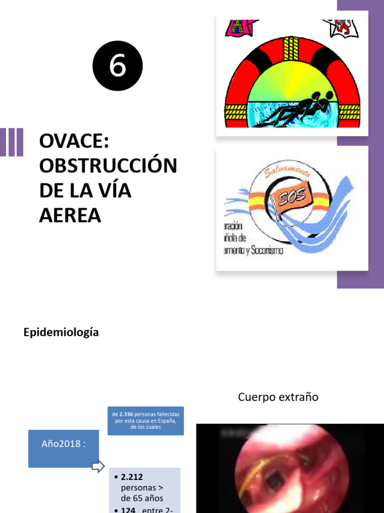 Prevención y Manejo de OVACE | PDF | Especialidades Medicas ...
