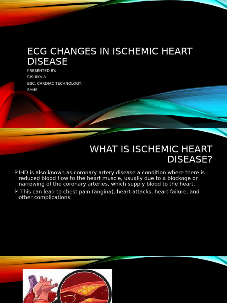 ECG Changes in Ischemic Heart Disease | PDF | Myocardial Infarction ...