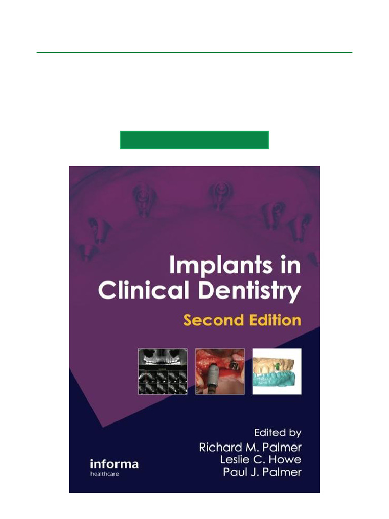 Implants in Clinical Dentistry, 2nd Ed. | PDF | Dental Implant ...