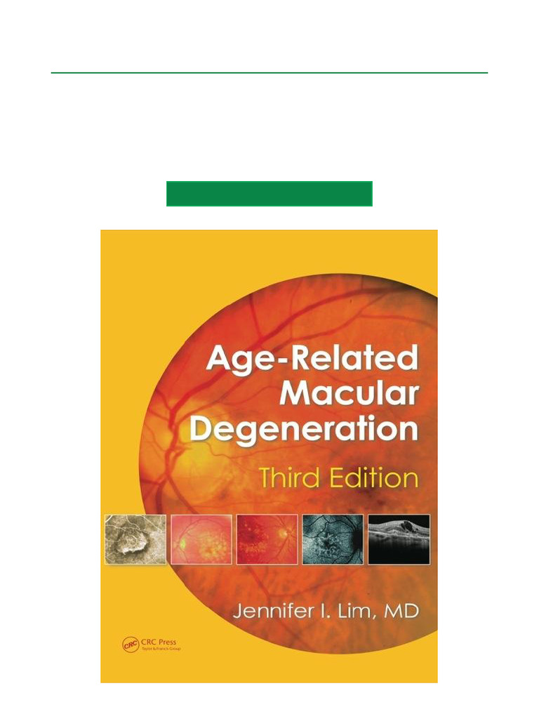 Age-Related Macular Degeneration Guide | PDF | Ophthalmology | Medical ...