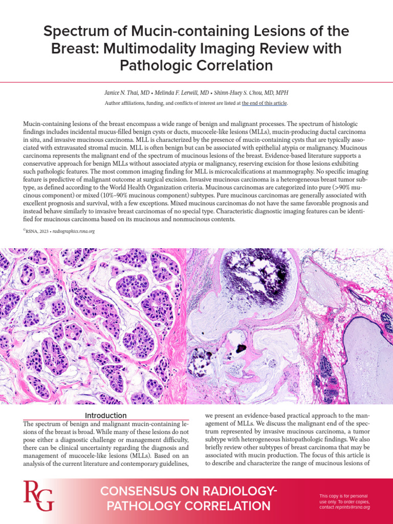 Mucinous Lesions: MLLs in Breast Pathology | PDF | Breast Cancer ...
