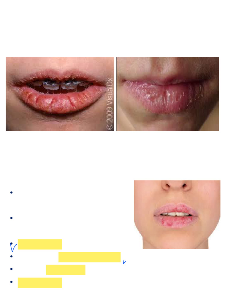 Week 10 Lecture Cheilitis | PDF | Skin | Clinical Medicine