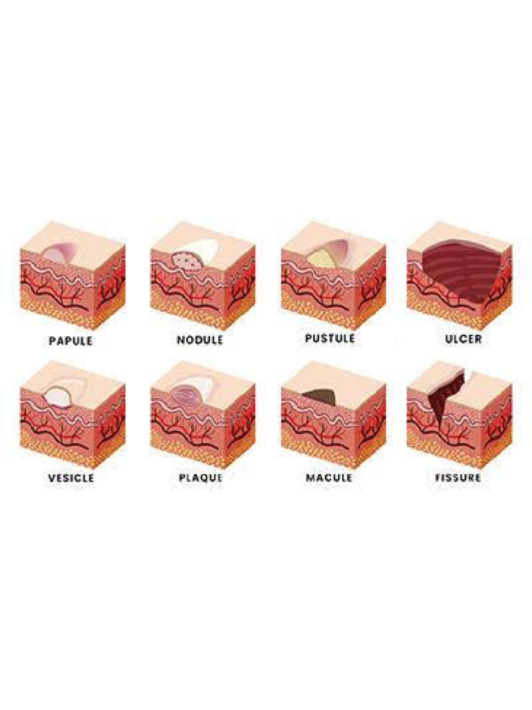 lesions | PDF