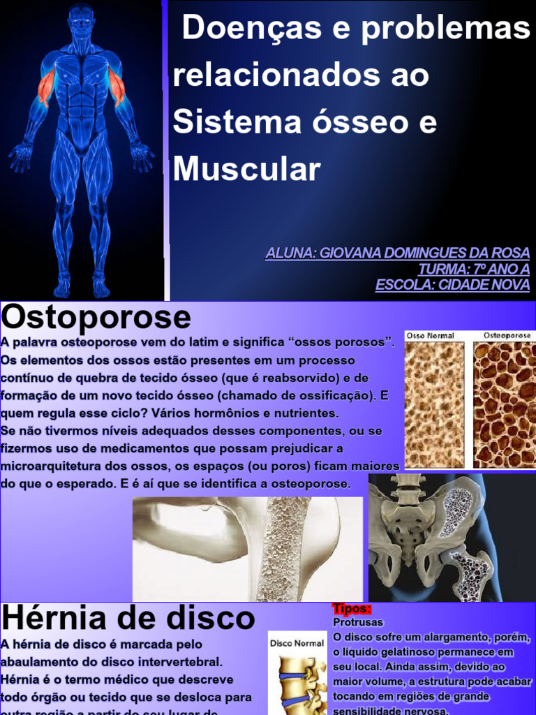 Doenças do Sistema Ósseo e Muscular | PDF | Coluna vertebral | Escoliose