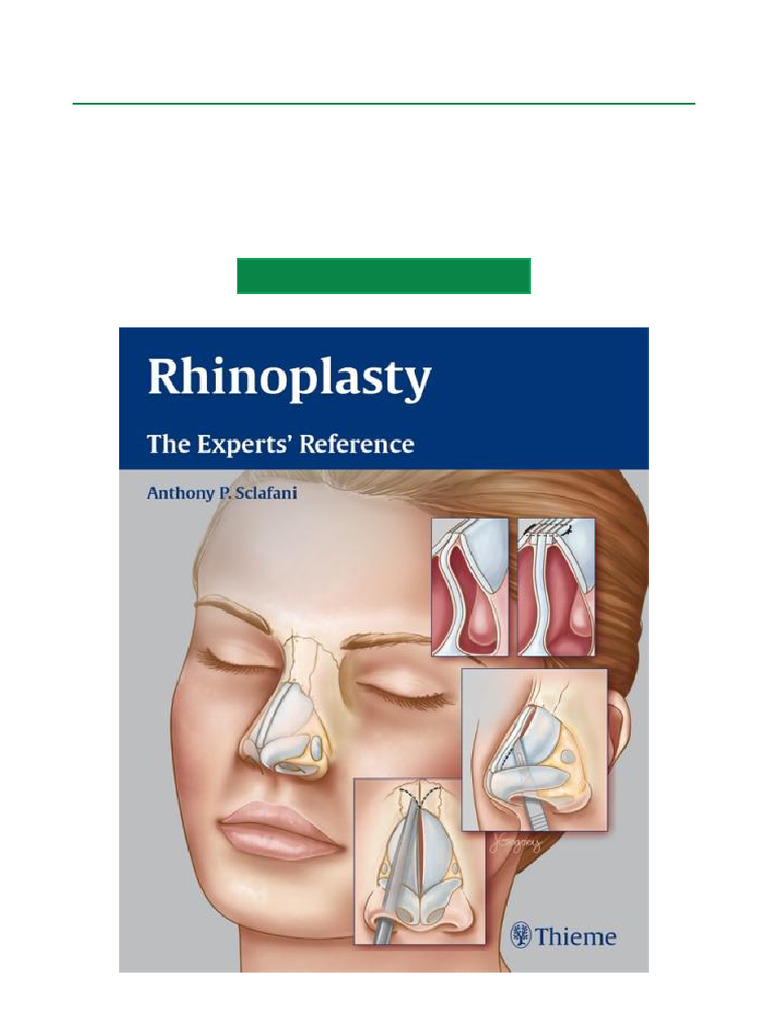 Immediate Get Rhinoplasty The Experts' Reference 1st Edition Full Book ...