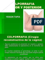 COLPORRAFIA