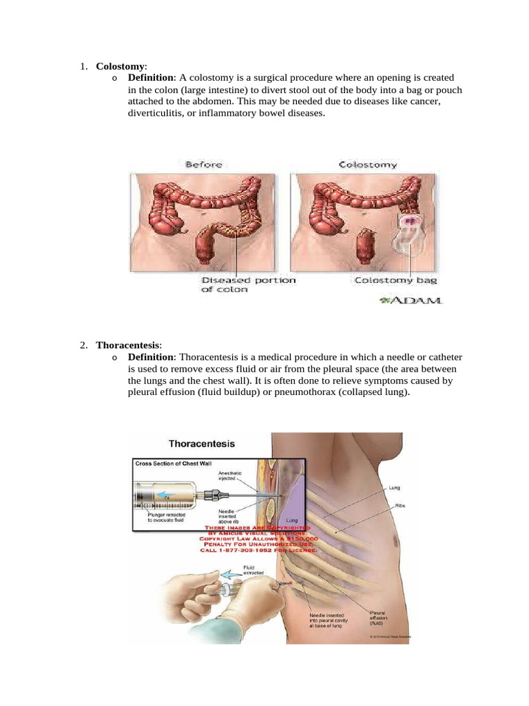 Colostomy Overview and Procedures | PDF