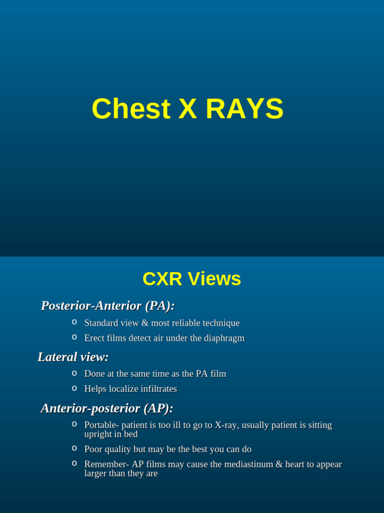 CXR Interpretation | PDF