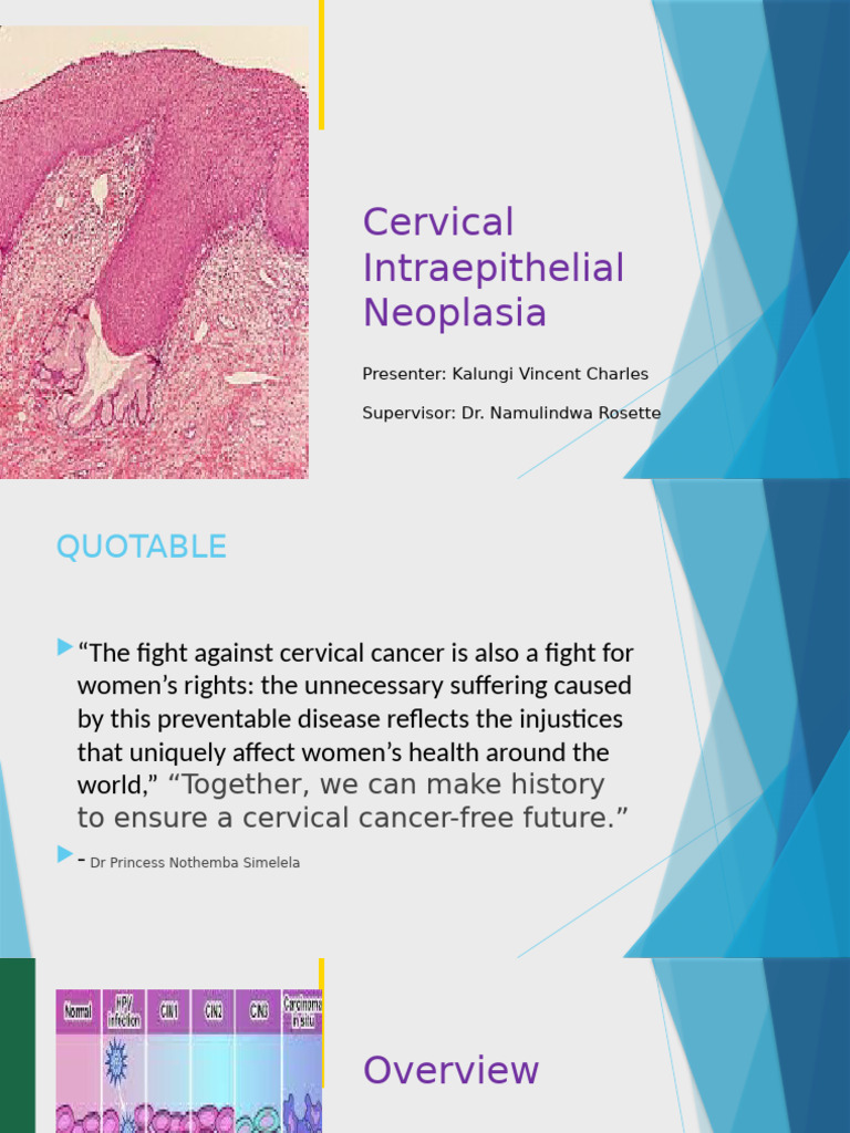 Cervical Intraepithelial Neoplasia | PDF | Cervical Cancer | Epithelium