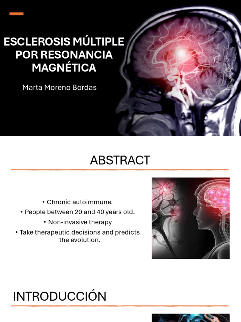 Presentation 3 | PDF | Esclerosis múltiple | Sistema nervioso