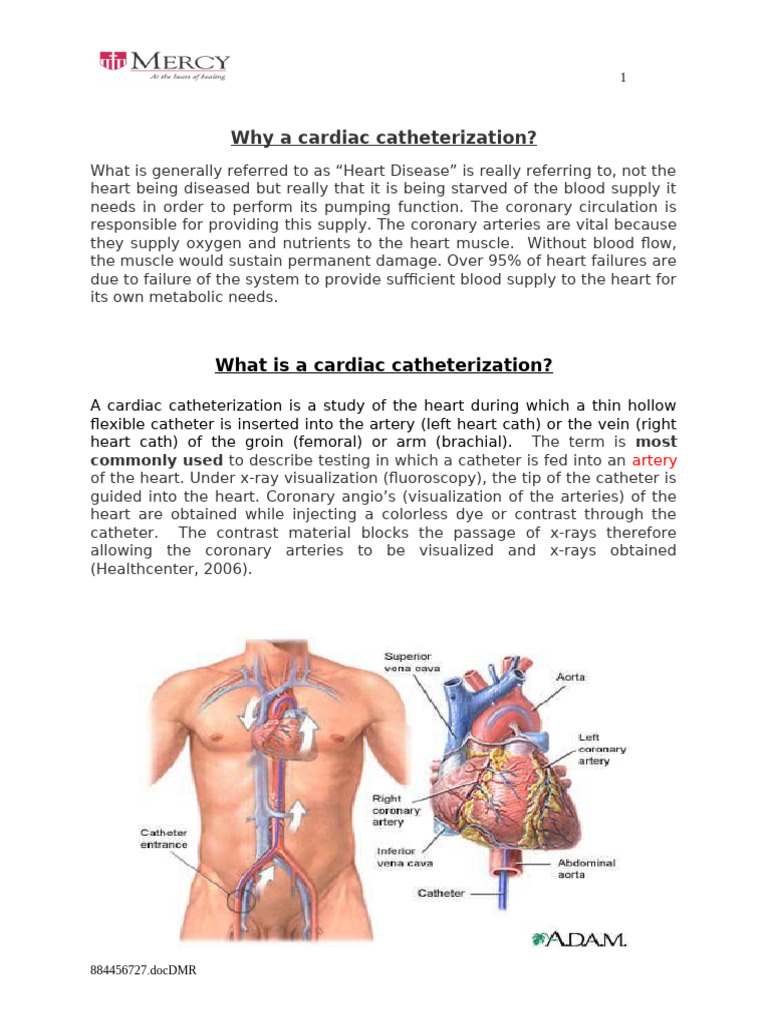 5B Review of Care For The Cardaic Cath Patient | PDF | Coronary ...