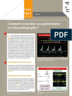 La Lettre Du Cardiologue Comment Rechercher Un Asynchronisme en Échocardiographie