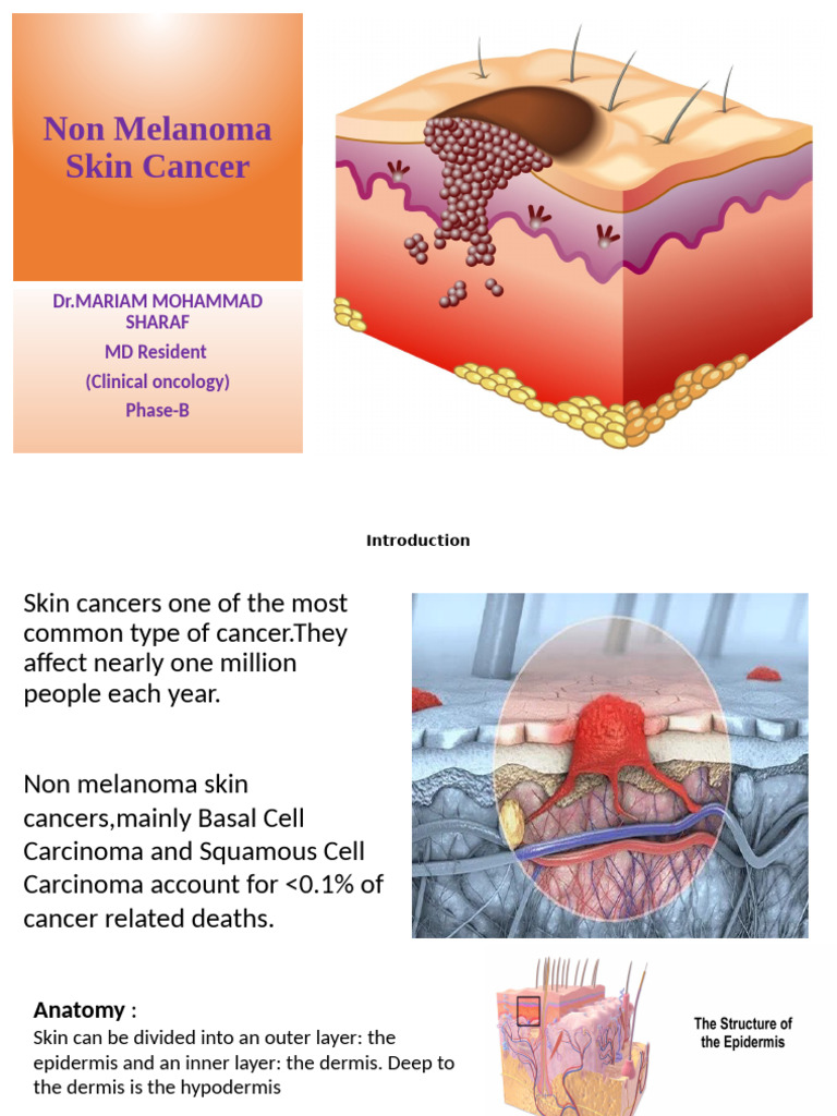 Non Melanoma Skin Cancer 2 | PDF | Biopsy | Radiation Therapy