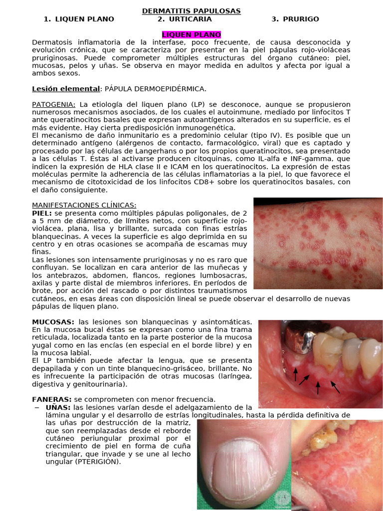 liquen-plano-causas-s-ntomas-y-tratamiento-pdf-alergia-citocina