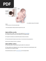 Download Spina Bifida by Ann Remz SN86144761 doc pdf