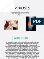 artrosis