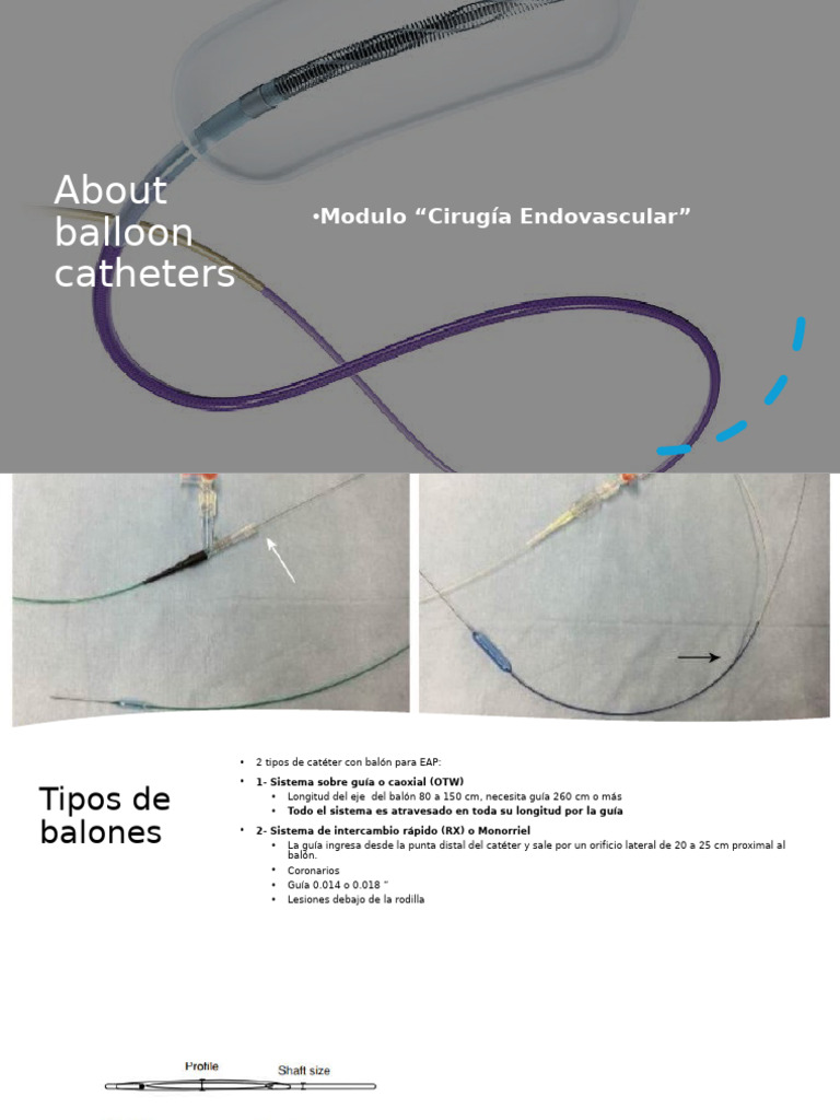 About Balloon Catheters | PDF
