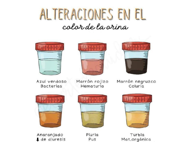 Alteraciones en El Color de La Orina | PDF