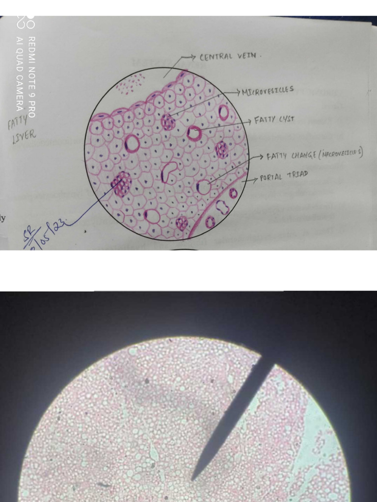 Pathology 23 Slides | PDF