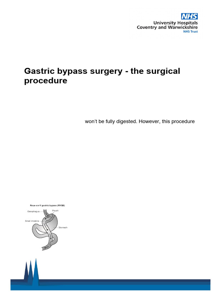 Gastric Bypass Surgery Overview Guide | PDF | Dietary Supplements | Surgery