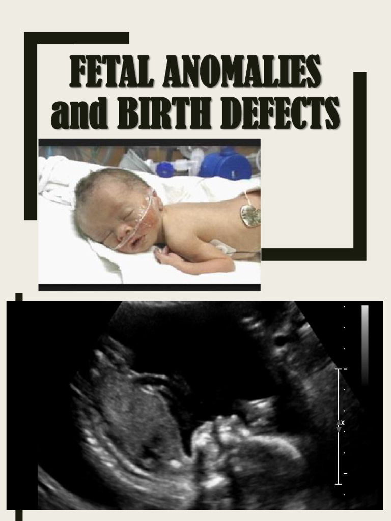 Understanding Fetal Anomalies and Defects | PDF | Genetic Disorder ...