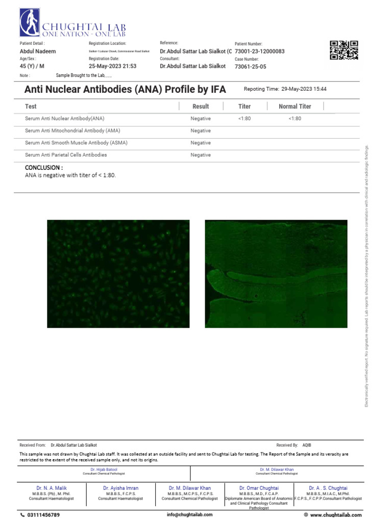 ANA Test Report for Abdul Nadeem | PDF | Immunology | Medical Specialties